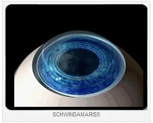 CIRUGIA LASER DE OJOS