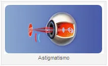 ASTIGMATISMO
