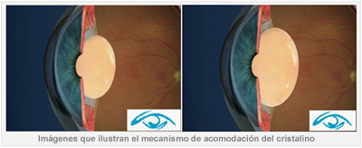 OJOS ENFERMOS