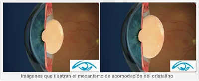 OJOS ENFERMOS