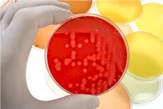 Imagen del artículo VIRUS DEL PAPILOMA HUMANO