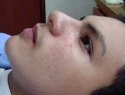 UNA NUEVA TENDENCIA DE BELLEZA