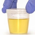 Urología
