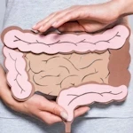 Coloproctología