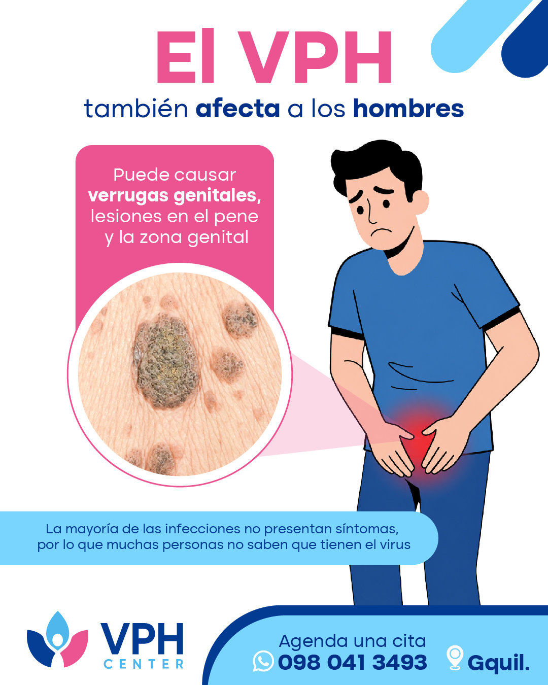 VPH en hombres: verrugas, lesiones y controles