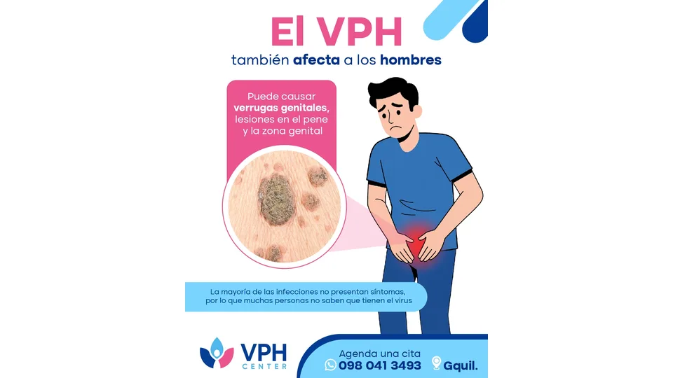 Imagen sobre VPH en hombres: verrugas, lesiones y controles